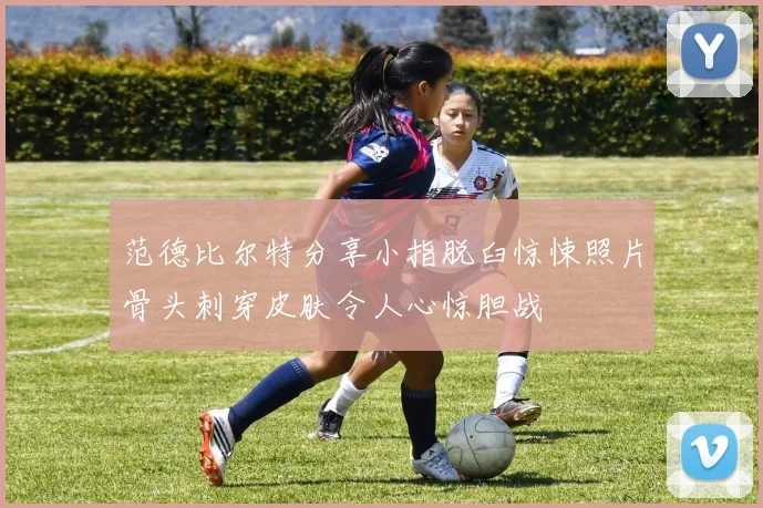 范德比尔特分享小指脱臼惊悚照片骨头刺穿皮肤令人心惊胆战